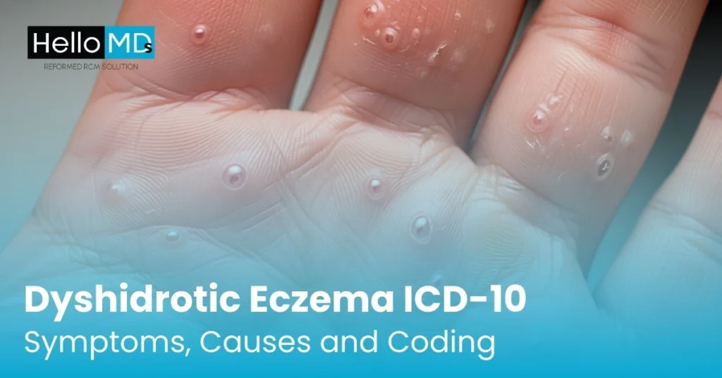 Dyshidrotic Eczema ICD-10: Symptoms, Causes and Coding